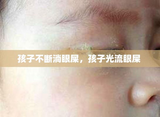 孩子不断淌眼屎,孩子光流眼屎