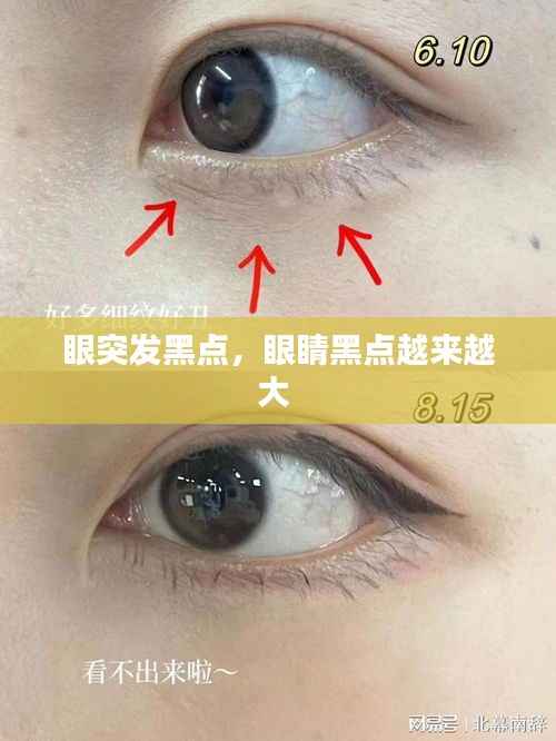眼突发黑点,眼睛黑点越来越大